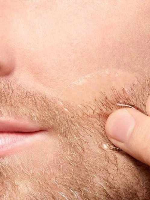 Clarins Men After Shave Soothing Toner - Image 5